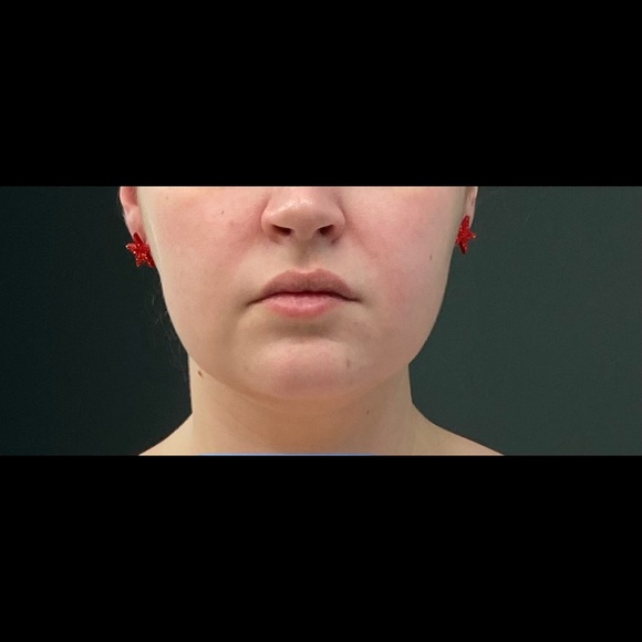 Red Stars - Picture 4 of 4